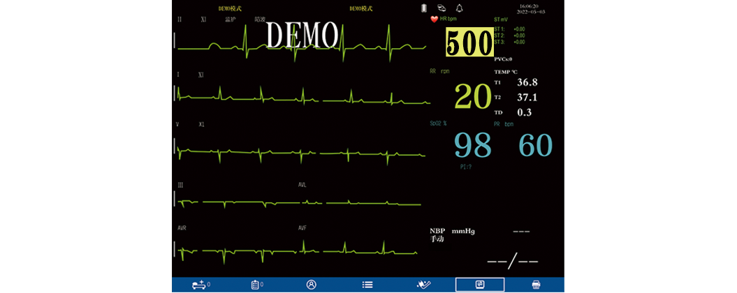HR heart rate range 20~500bpm, meeting the heart rate characteristics of different animals