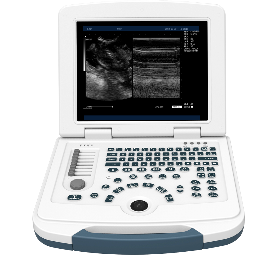 Tecnología de imagen digital de haz múltiple para imágenes más claras