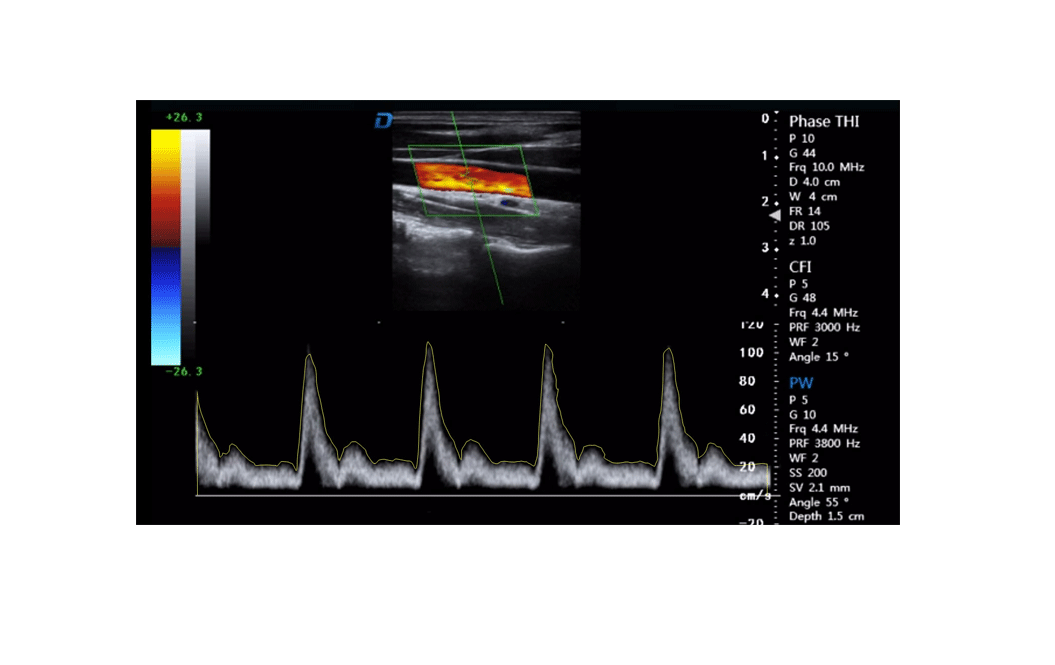 Spatial Compound Imaging Technology 